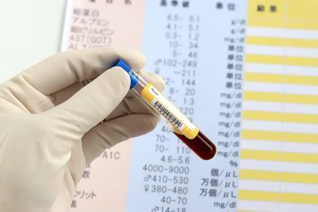 人間ドック