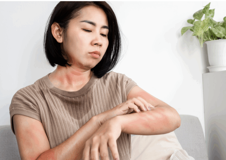 【月経疹】生理のたびに湿疹が来る方へ。産婦人科医が説明